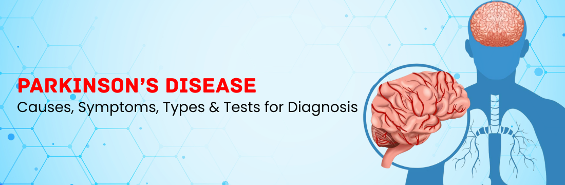 Parkinson’s disease: Its Causes, Symptoms, Types and Tests for Diagnosis
